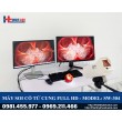 MÁY SOI CỔ TỬ CUNG FULL HD MỚI NHẤT